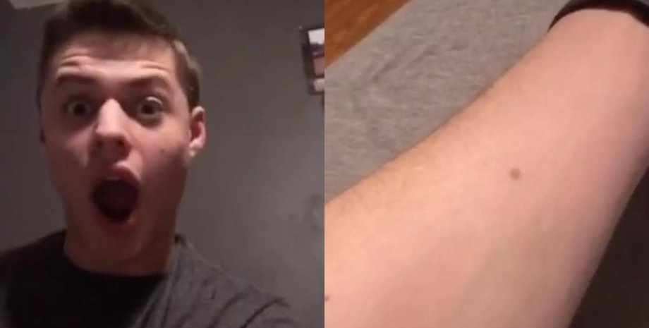 Веснушки на руках, родинки, курьезы, необычная теория, люди ищут веснушки на теле, научное объяснение, вирусный ролик