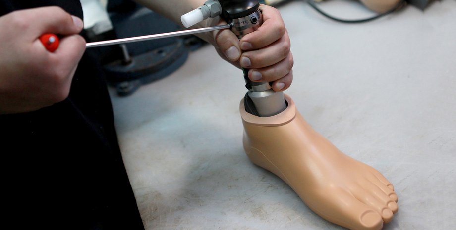 протез, протези україна, протезування україна, безкоштовні протези, безкоштовні протези україна