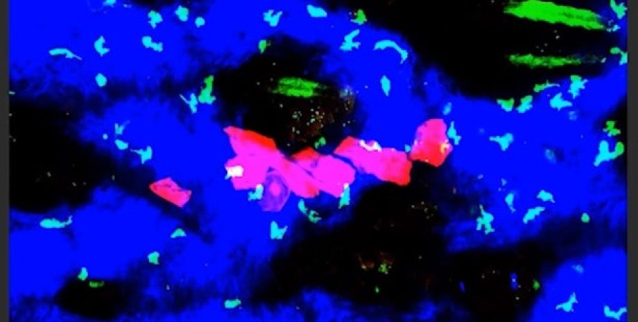Т-клетки (зеленые) держат под контролем клетки опухоли (красные) / Фото: New Atlas