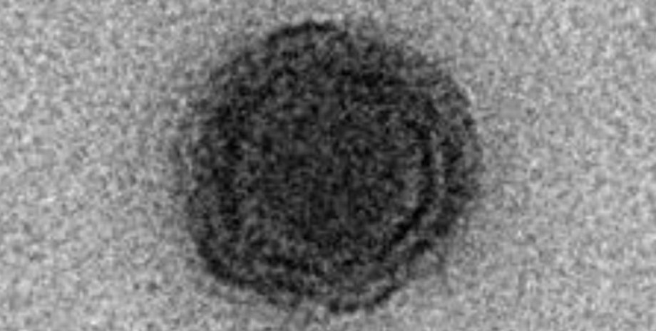 Негативное изображение изолированного яравируса. Фото: bioRxiv