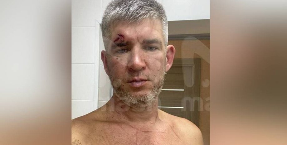 избитый мужчина, олег из севастополя, жена избила мужа