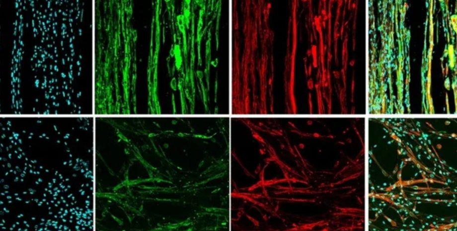 м'язова тканина невагомість