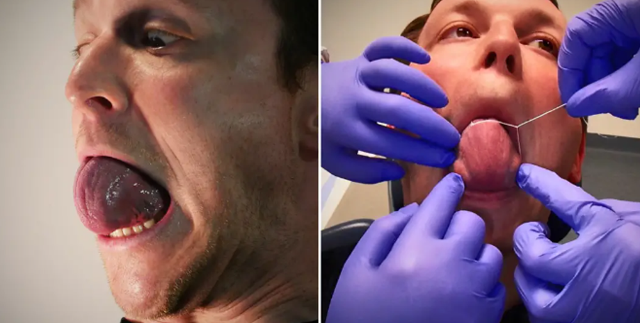 Саша Файнер из Бельгии имеет самый большой в мире язык, титулы, Книга рекордов Гиннеса, фото, курьезы