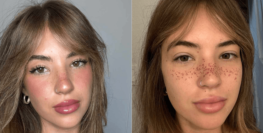 Девушка сделала татуировку веснушек на лице и нарвалась на критику