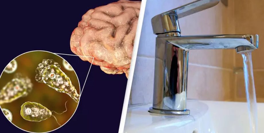 Кран, вода, бактерія, мозок, захворювання, інфекція, зараження, Naegleria fowleri