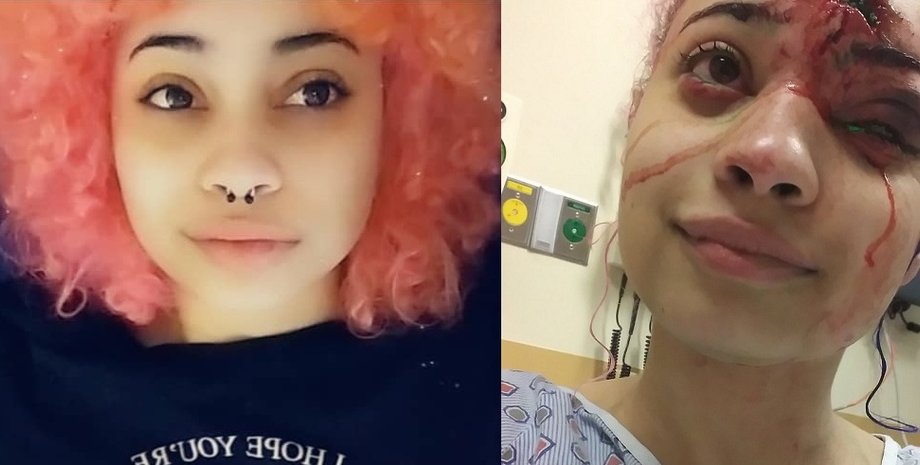 Шаннин до и после ранения / Коллаж