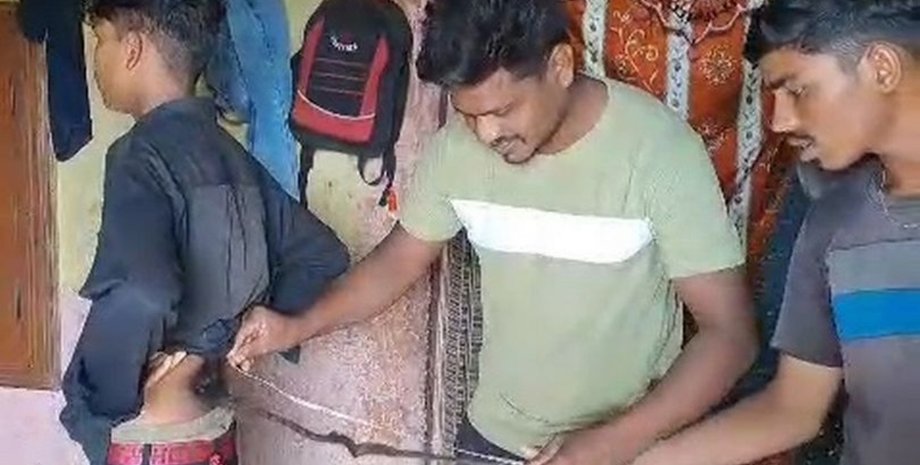 Мальчик с хвостом, хвост обезьяны, хвост, волосы похожие на хвост, волосы со спины, растет хвост, клок волос