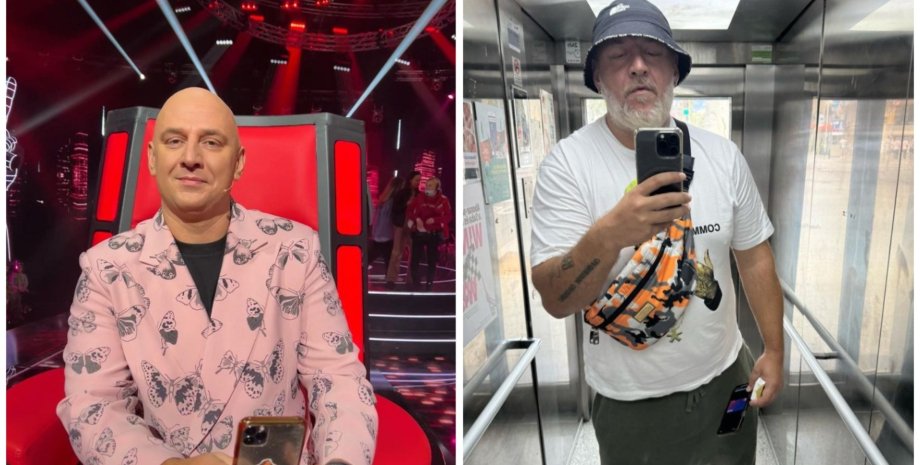 Потап как изменился внешне Потап внешние изменения, Потап пластические операции, хирург о внешности Потапа, хирург о внешности Потапа