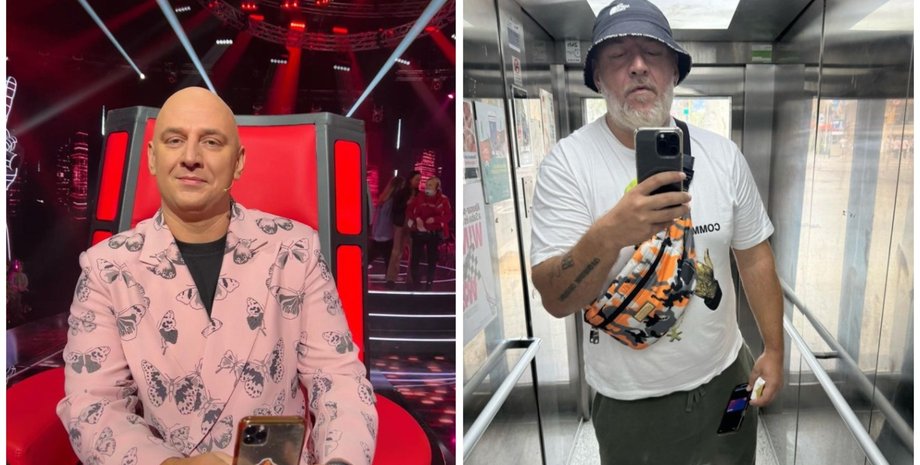 Потап зовнішні зміни, Потап пластичні операції, хірург про зовнішність Потапа