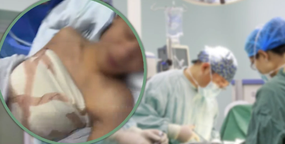 Увеличение груди обманом, в Китае 19-летнему парню увеличили грудь, мошенническая схема, прямые трансляции