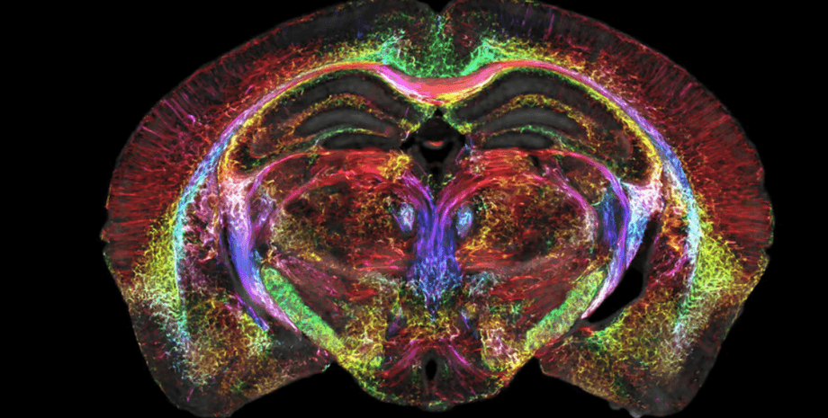 мрт, мозг, визуализация мозга