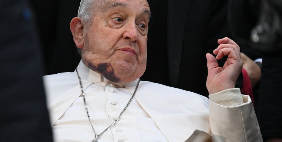 Папа Римский Франциск, Папа синяк, церемония Базилика Святого Петра, здоровье Папы, война в Украине, Папа Франциск падение, Папа Римский позиция по войне, Папа Франциск 2024