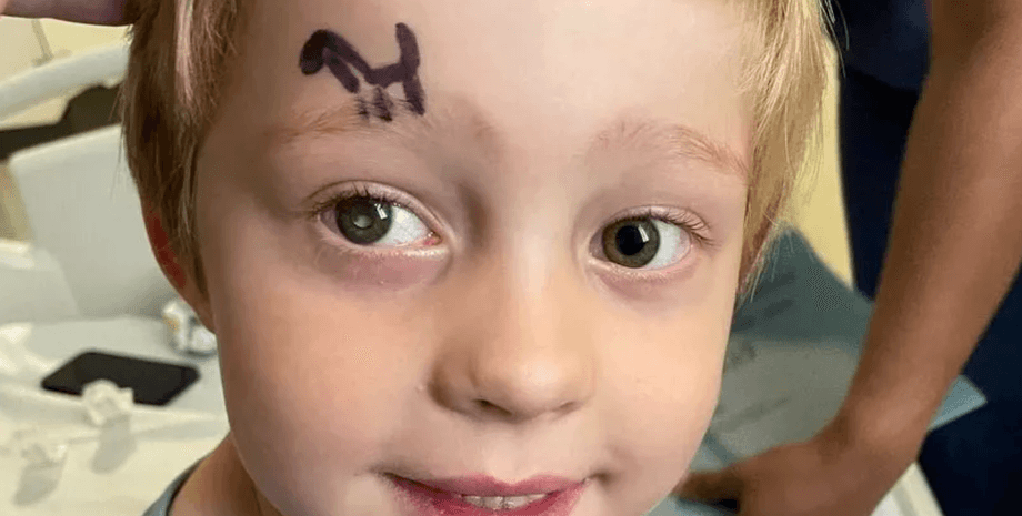 рак ока, як виглядає рак очей