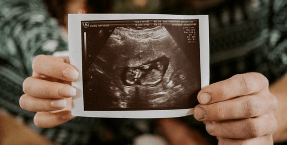 Зачаття дитини, запліднення, фертильність, підміна сперми, UW Medicine, США
