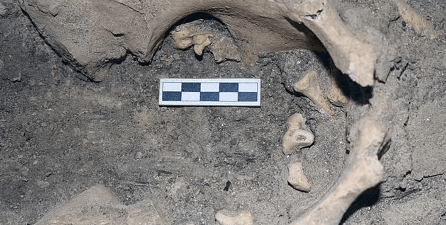 Застарелая опухоль яичника, Тератома с зубами, Археологическая находка, Останки египетской женщины, Символика плодородия, Тератома как редкость, Древние медицинские заболевания, Символика обручального кольца Бес