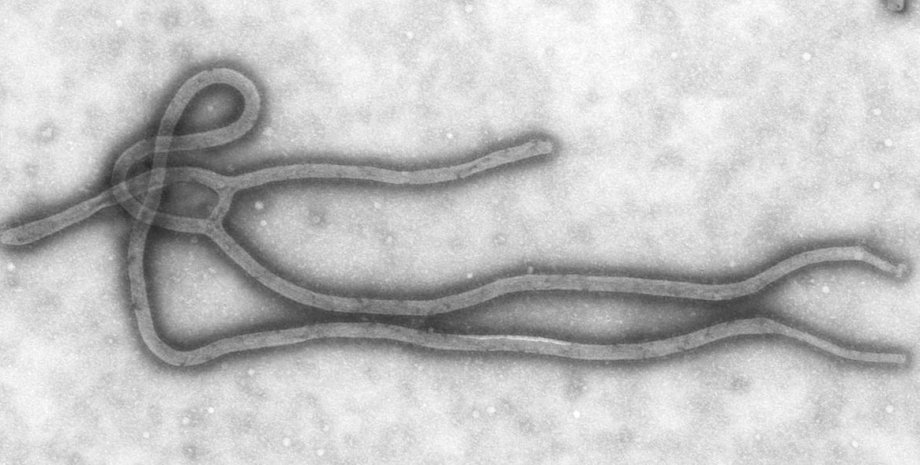 Изображение вируса Эбола под микроскопом. Centers for Disease Control