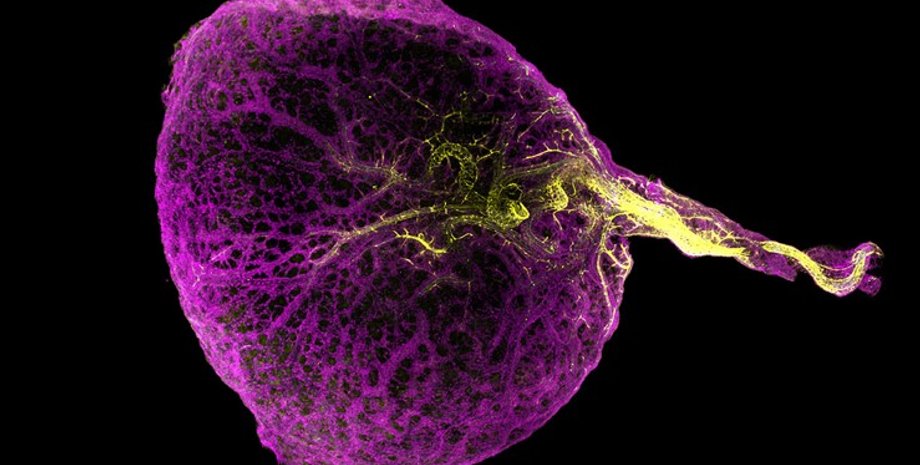 жовтковий мішок