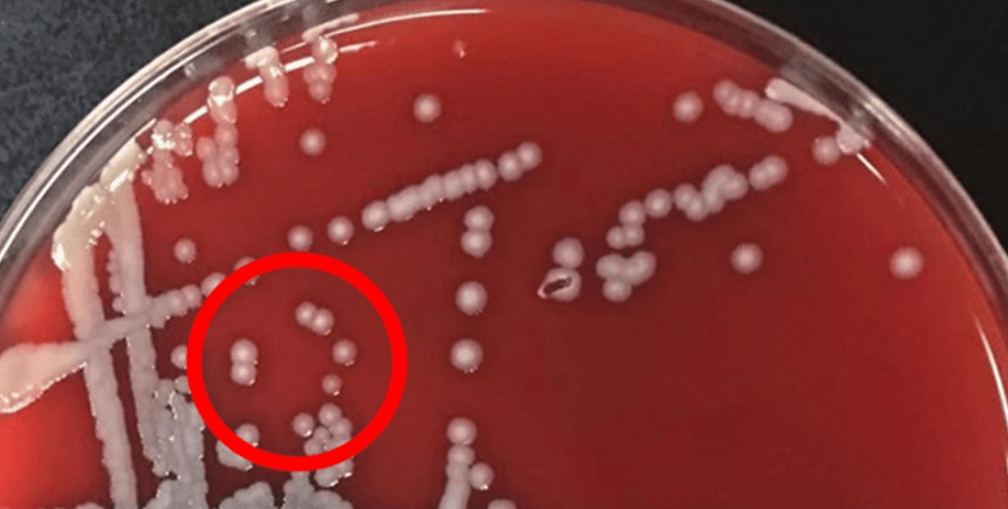 бактерія, колонія бактерій