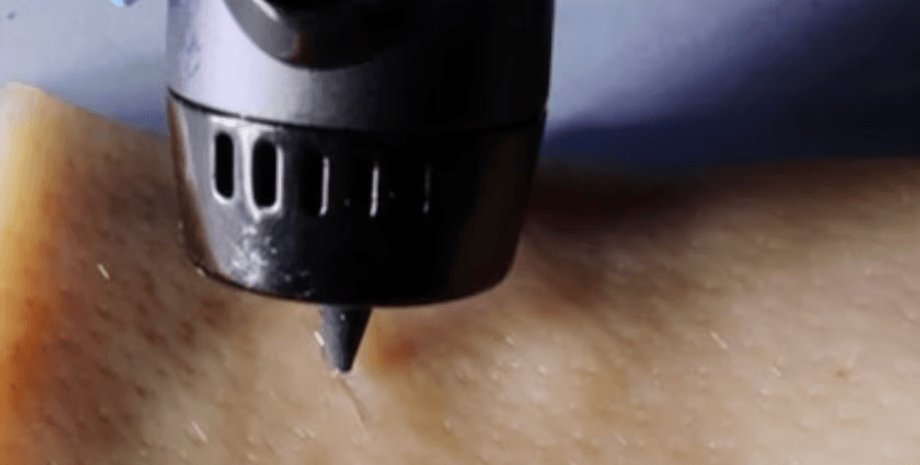 биоручка, ручка, ручка от ран