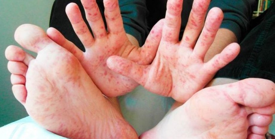 Фото: AVDEEVKA.CITY