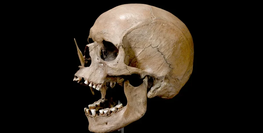 Генетичне походження розсіяного склерозу, Древня ДНК і ризик захворювань, Генетичні варіанти у північних європейців, Походження аутоімунних захворювань, Імунітет та аутоімунні захворювання