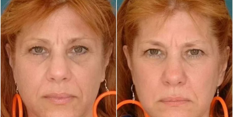 Однояйцевые близняшки, как изменилась их внешность, учитывая различные перипетии судьбы, интересный эксперимент