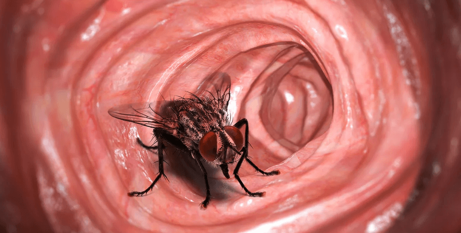 Муха в желудке человека, живая муха, живая муха в кишечнике, необычный случай, загадка для врачей, желудок человека, здоровье