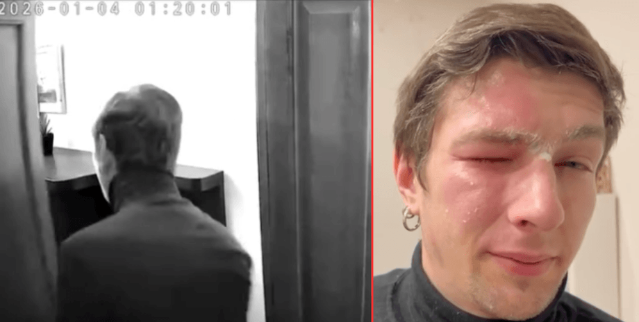Андрій Кулько Ветеран Андрій Кулько став жертвою нападу сусідки
