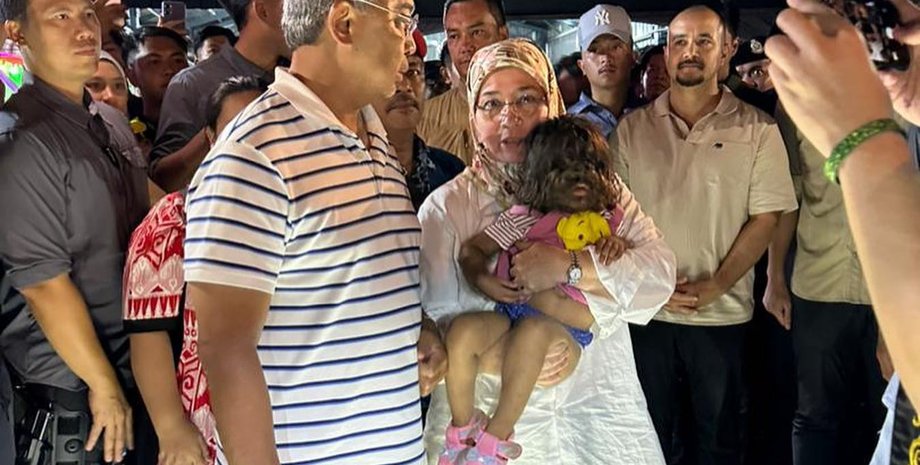 королівська сім'я Малайзії, волохата дитина, генералізований гіпертрихоз