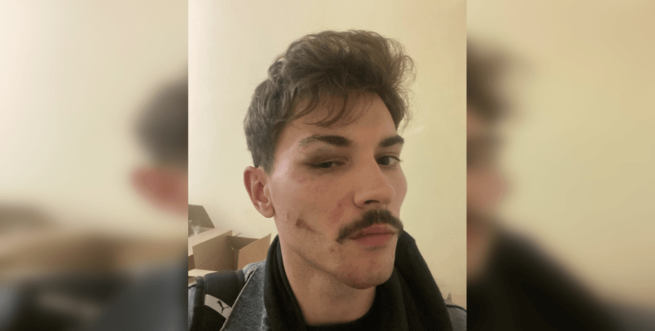 Владислав Каплиенко, избили ТЦК, мобилизация в Украине