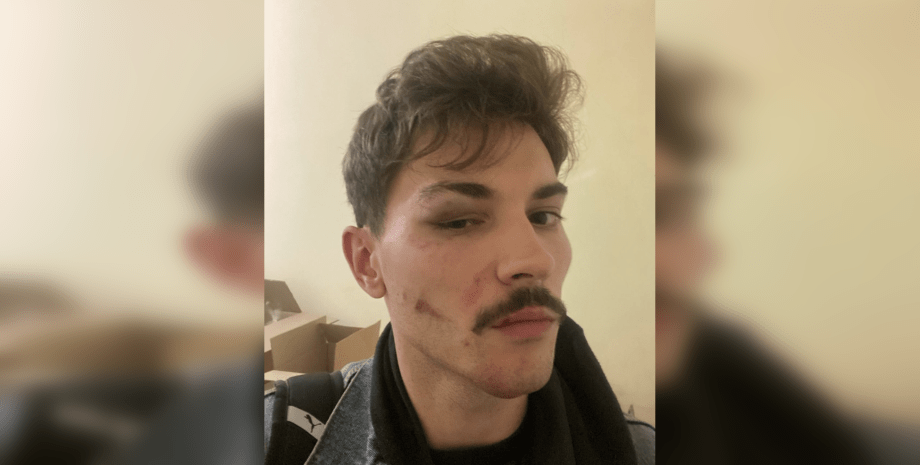 Владислав Каплиенко Владислав Каплиенко, избили ТЦК, мобилизация в Украине