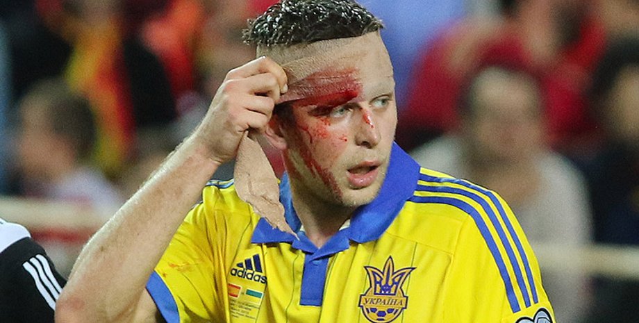 Артем Кравец / Фото: Динамо от Шурика