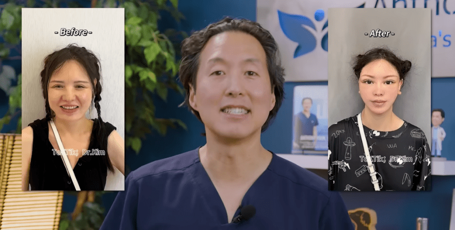 Пластическая операция на лице, хирург, хирургическое вмешательство, внешняя трансформация, фото до и после, США, Китай