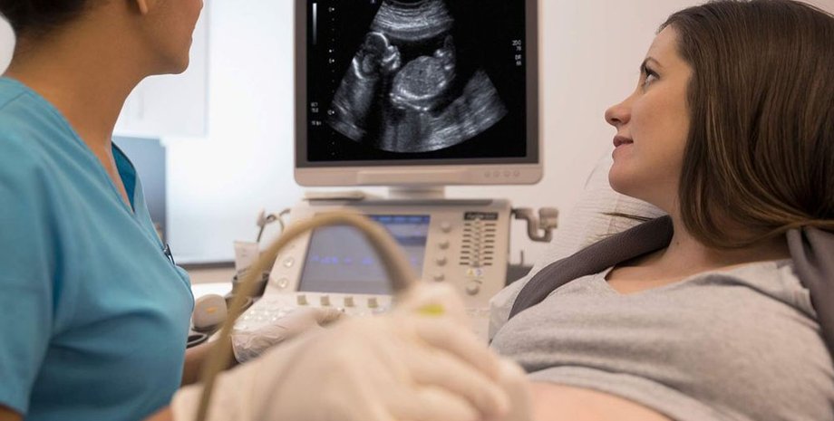 Беременная женщина испугалась, когда увидела своего ребенка на УЗИ, удивительные случаи из жизни