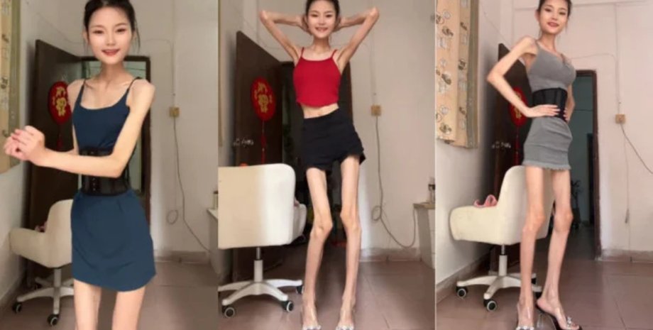 Худа жінка, жінка важить 25 кг, дієта, екстремальне схуднення, авторка контенту, анорексія,