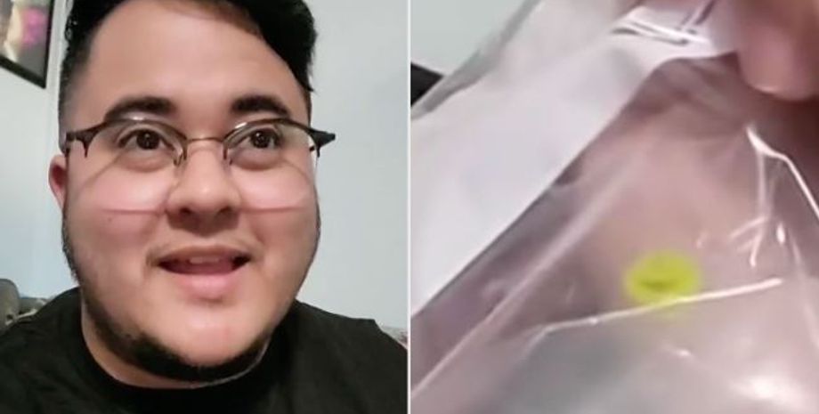 Энди Нортон жил с куском Lego в носу, конструктор, интересные истории, обоняние, странные расстройства, курьезы, странные истории из жизни