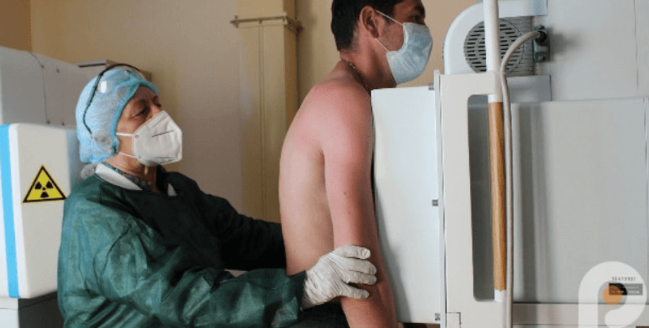 Флюорографія