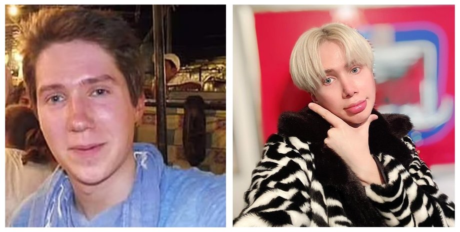 Оли Лондон, пластическая операция, коллаж