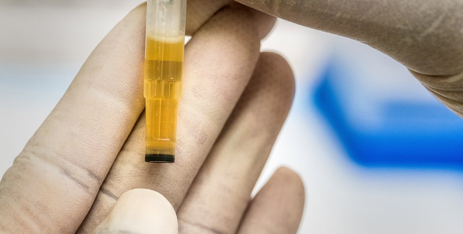моча, тест, пробирка