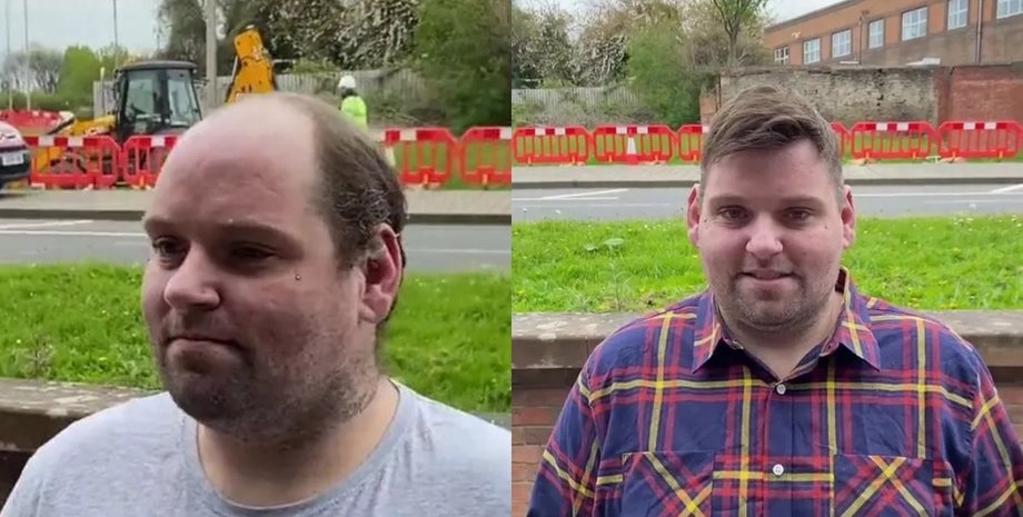 Чоловік розридався через зачіску, лисіючий чоловік, лисина, облисів на маківці, втратив волосся, повернули волосся, зачіска