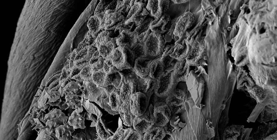 труп людини, розкладання