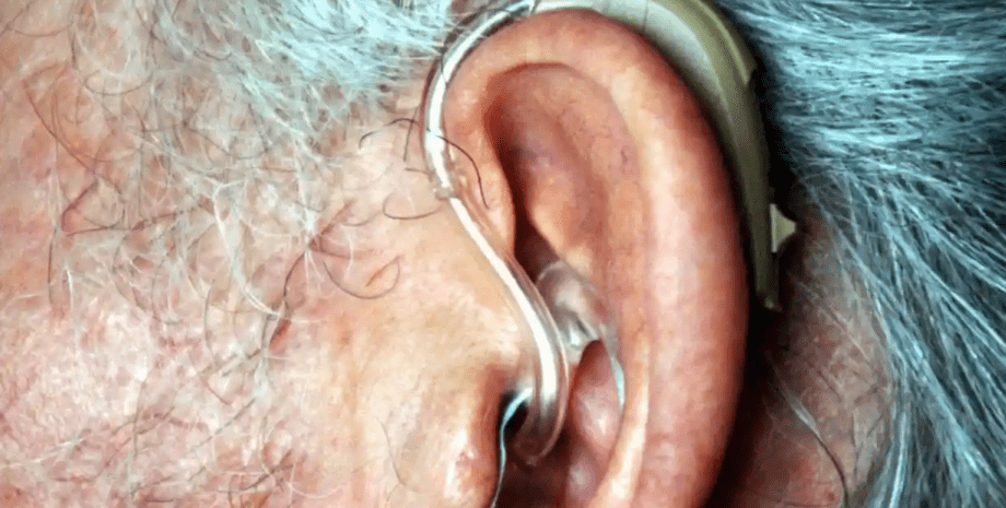 слуховой аппарат, седина