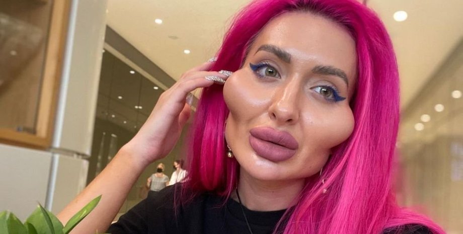 Анастасія Покрещук, українка з найбільшими у світі вилицями, пластичні операції, зовнішність, епатаж, фото