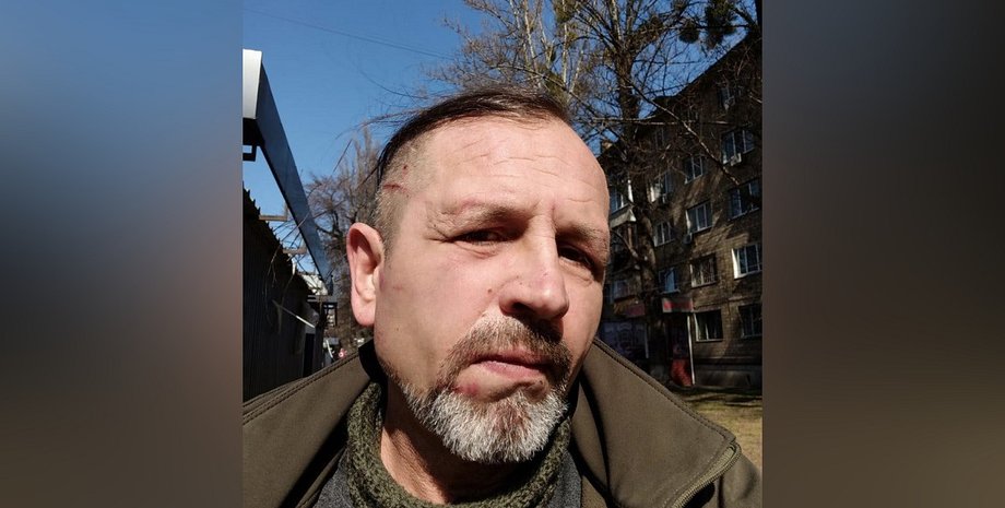 Бывший политзаключенный Владимир Балух пострадал в ТЦК