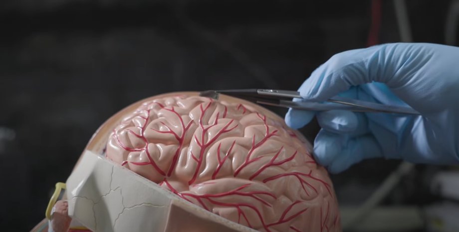 Ученые установили чип-имплант на модель мозга