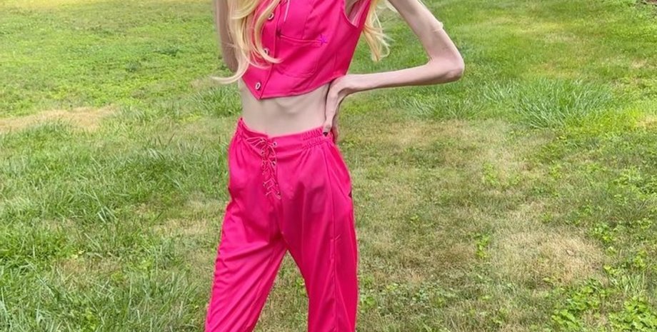 Евгения Куни, блогер, анорексия