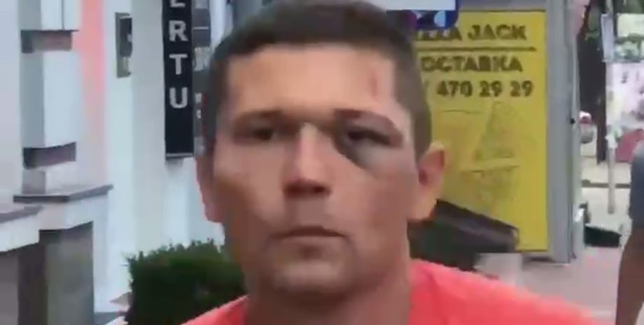 УДО, співробітник, Дорофєєва, танцюрист, побиття,