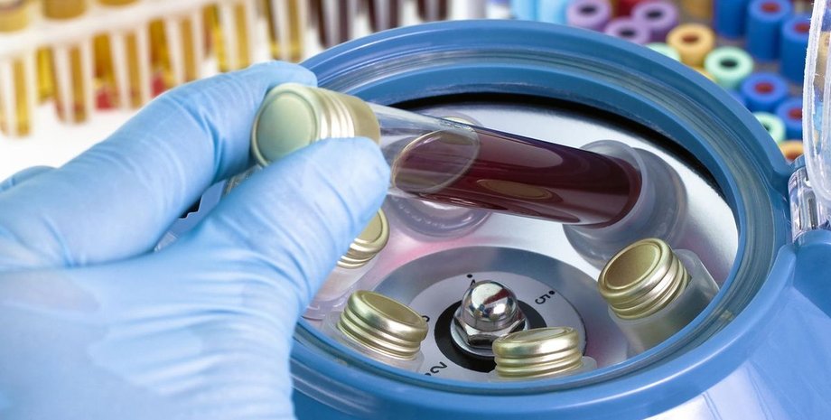 Франция, коронавирус, COVID-19, штамм, ПЦР-тесты,