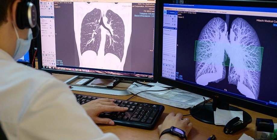 Легкие больного коронавирусом, коронавирус, лечение коронавируса, снимок