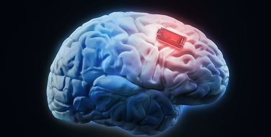 моговые чипы, мозговые импланты